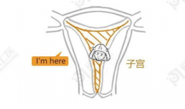 扩子宫漫画,揭秘女性生育困境与自我救赎之路