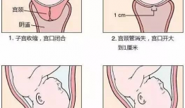 扩子宫漫画,揭秘女性生育困境与自我救赎之路